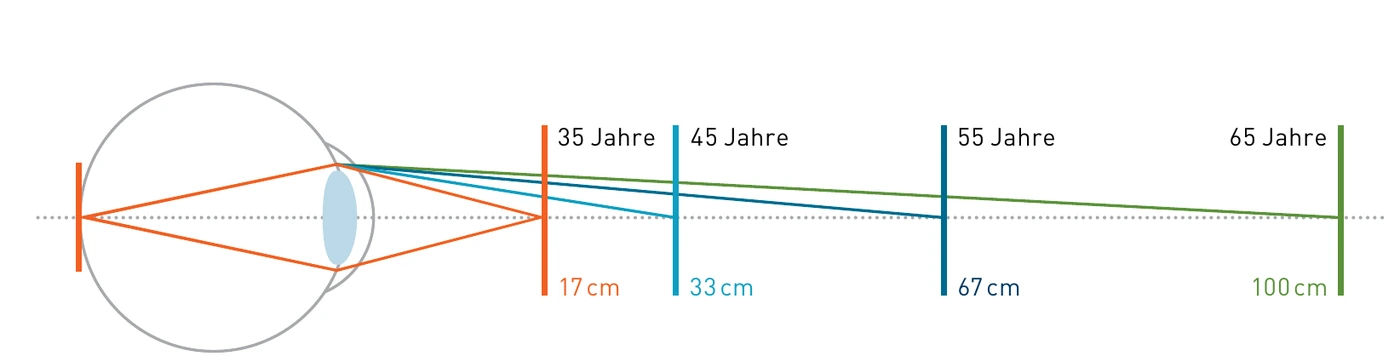 Diagramm: Der Nahpunkt rückt mit dem Alter weiter weg – von 17 cm mit 35 Jahren bis 100 cm mit 65 Jahren